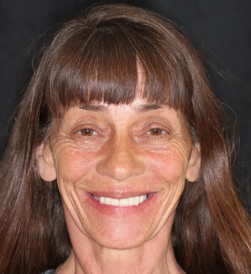 Case 2 — before treatment at Capital Dental Group