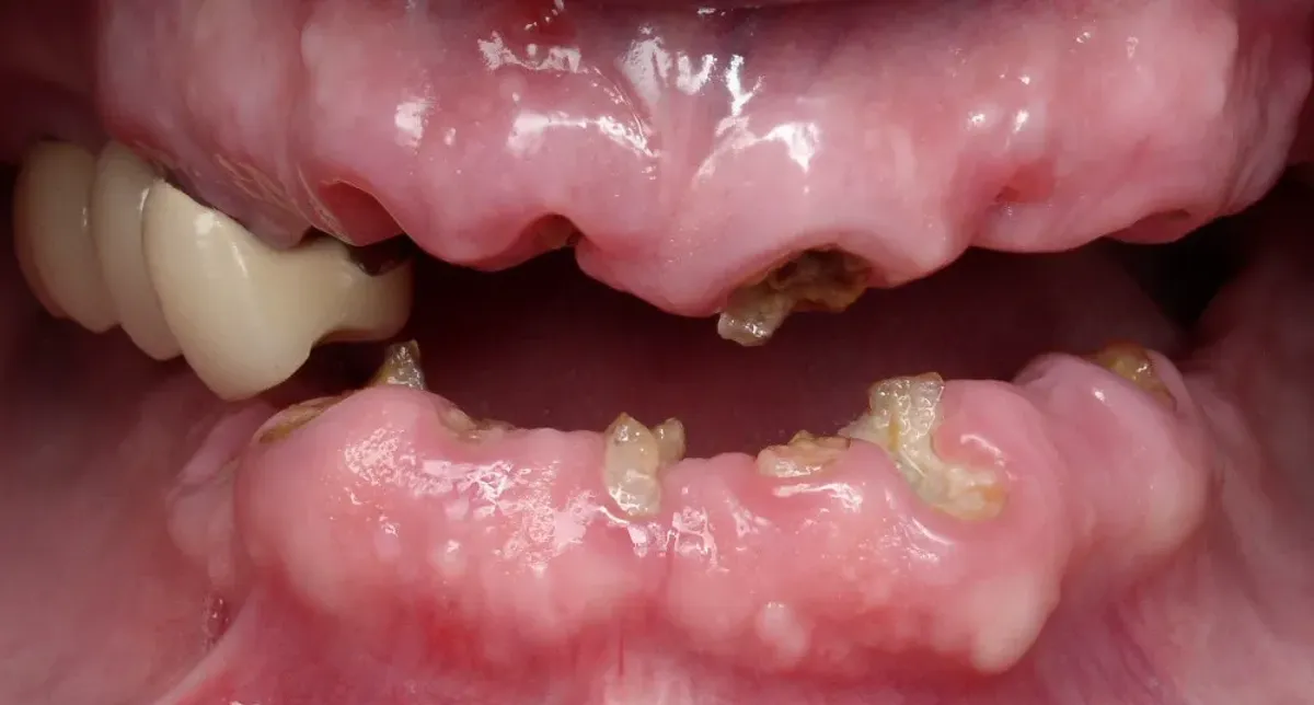 Case 7 — before treatment at Capital Dental Group