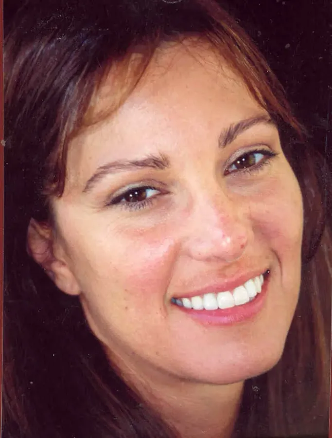 Case 8 — after treatment at Capital Dental Group