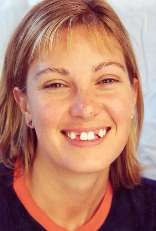 Case 8 — before treatment at Capital Dental Group