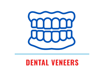 Dental veneers